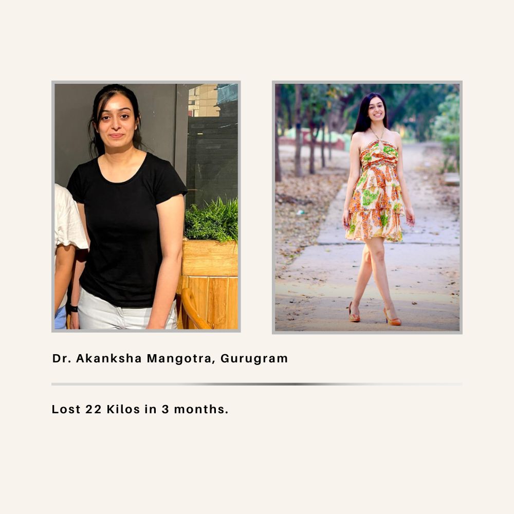 Dr. Akanksha — Fat Loss Transformation — Dr. Maruti Sharma MTP™ Method